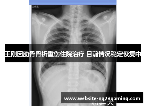 王刚因肋骨骨折重伤住院治疗 目前情况稳定恢复中